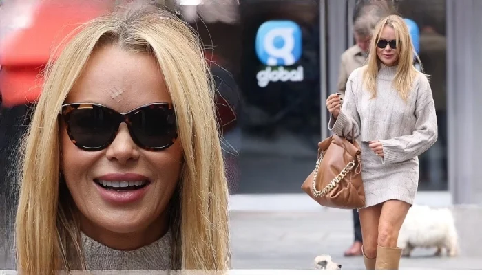 Amanda Holden Shocking New Look: Stitches on Forehead After a Painful Mishap!